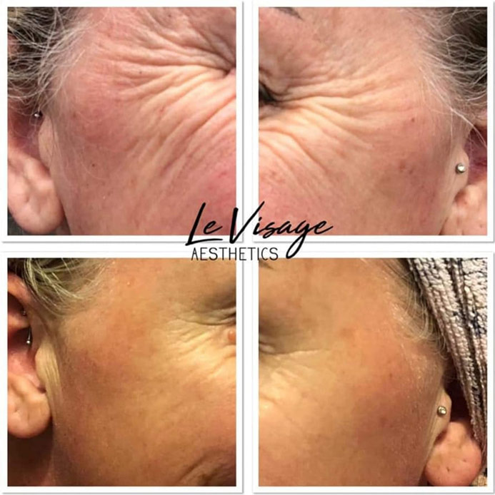 Le Visage Before and After Results Gallery Le Visage Before and After Results Gallery