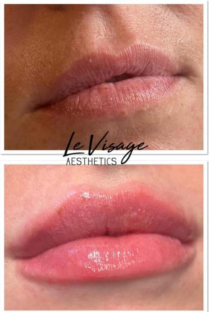 Le Visage Before and After Results Gallery Le Visage Before and After Results Gallery