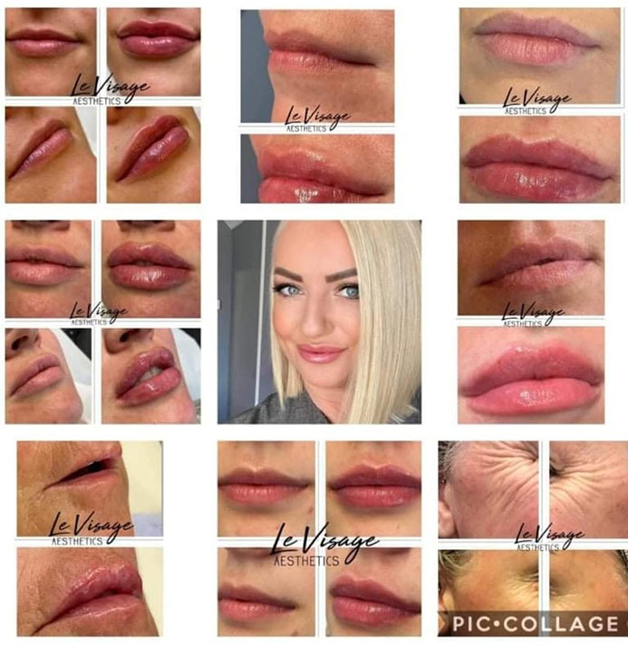 Le Visage Before and After Results Gallery Le Visage Before and After Results Gallery