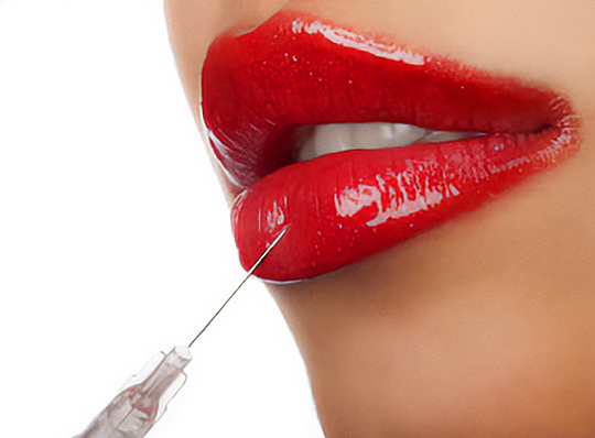 Lip Fillers NV Salon